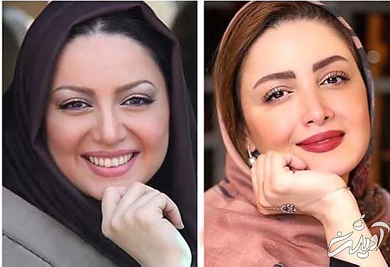 جراحی افتادگی پلک؛